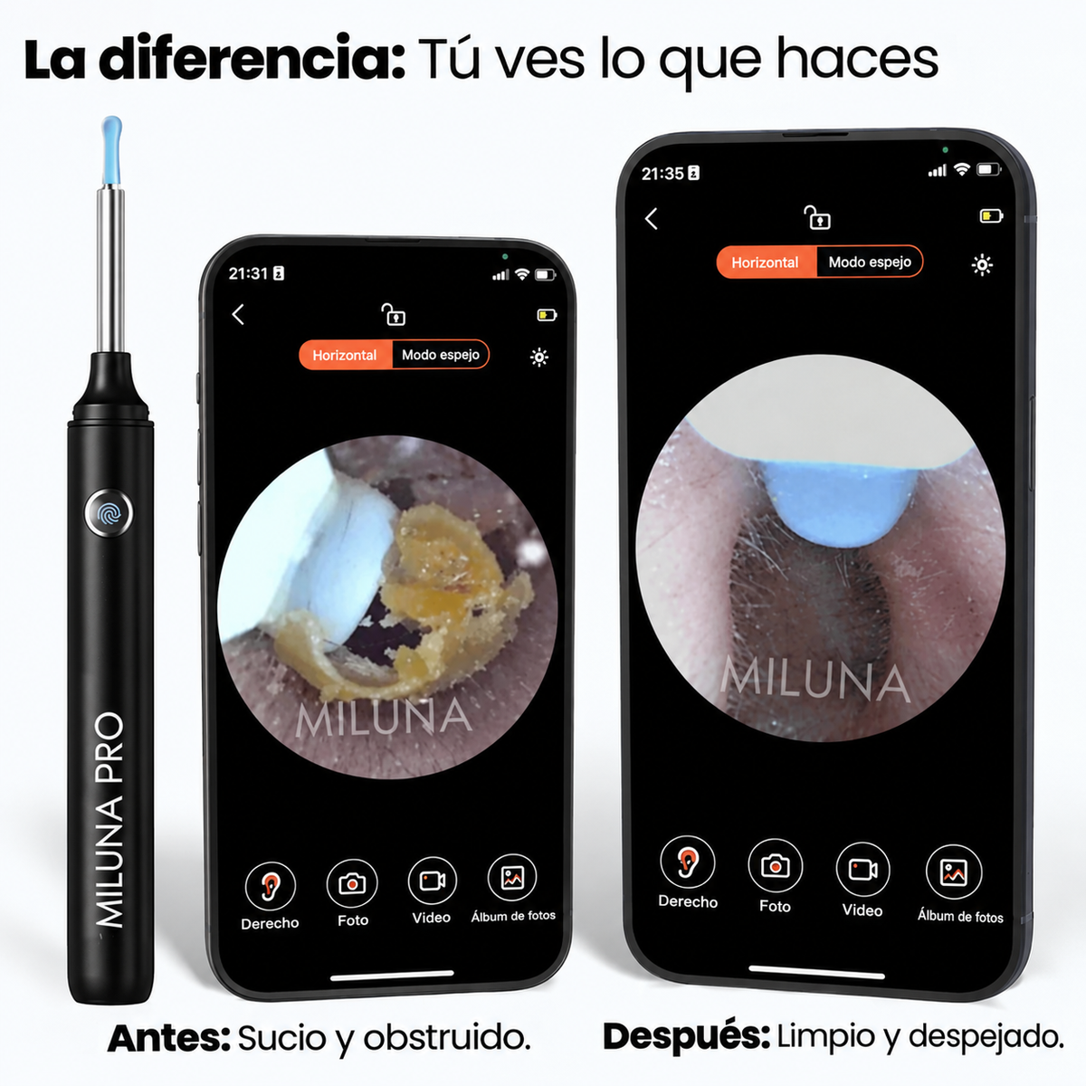 limpiador de oídos con SmartView