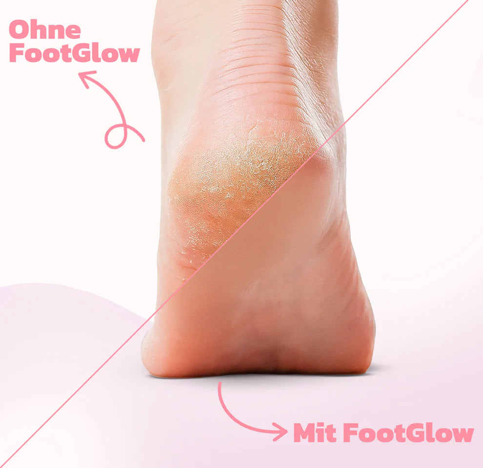 Removedor de callos eléctrico💗| 100% Original — Evita imitaciones baratas