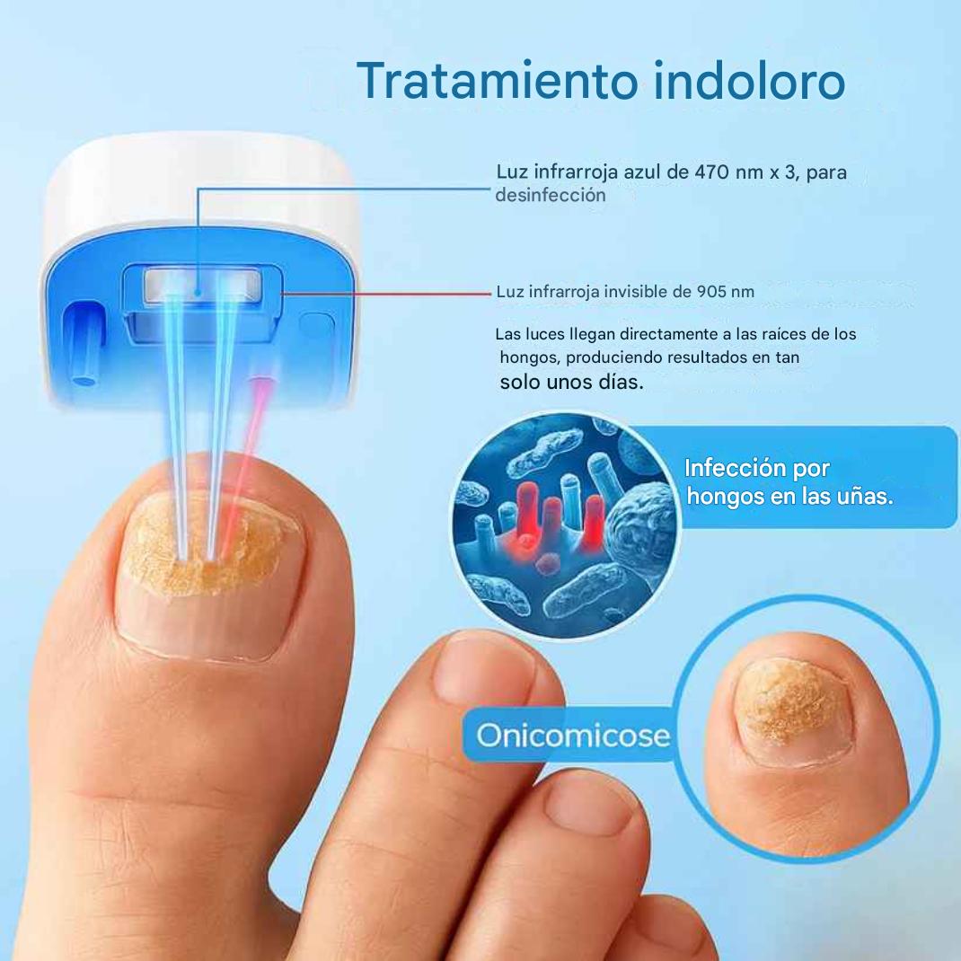 Luminail Pro™ – Tecnología Láser Avanzada para el cuidado de tus uñas