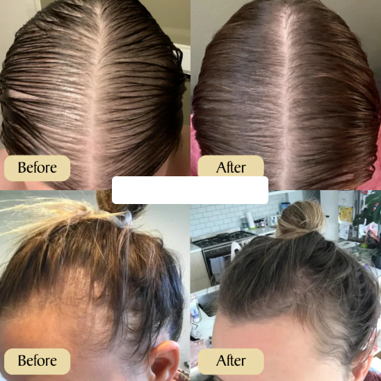 Botanic Batana Oil: Aceite natural para el crecimiento del cabello