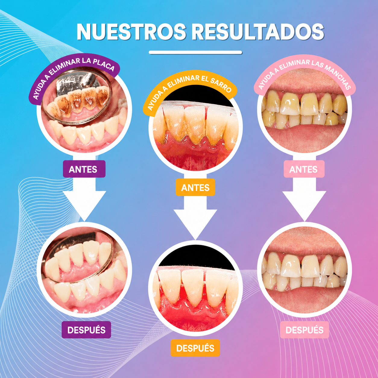 Limpiador dental ultrasónico