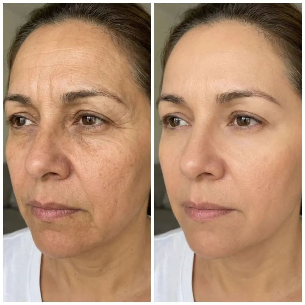 PDRN MULTI Bálsamo Volumen y Brillo Sin Agujas Lisse X2 UNIDADES