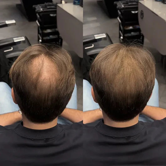 #1 más vendido-Polvo corrector para el cabello PROMO BLACK DAYS 2 X 1