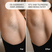 LumiSkin- Depilación permanente IPL