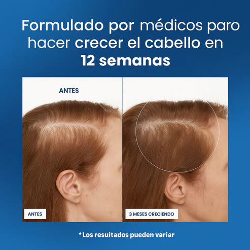 Roll-On Original de Crecimiento Capilar™ OFERTA ESPECIAL PAGA 1 Y LLEVA 2🎁