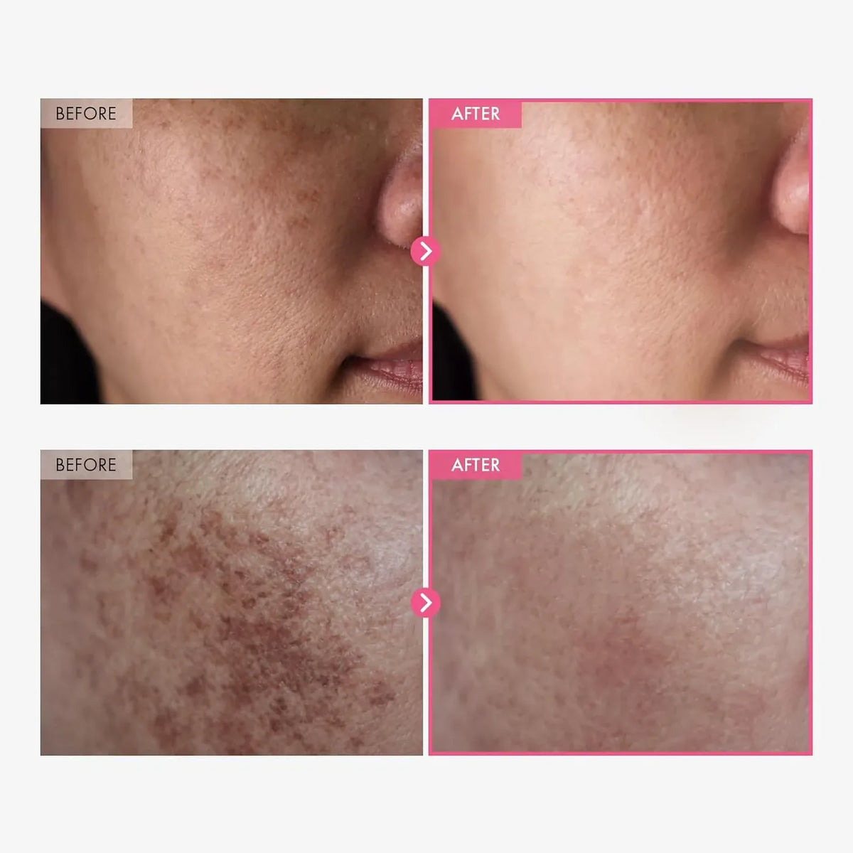 Cuando los químicos coreanos formulan una crema para manchas oscuras